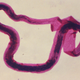 A photomicrograph of Brugia malayi in larval form, one of several roundworms that can cause lymphatic filariasis